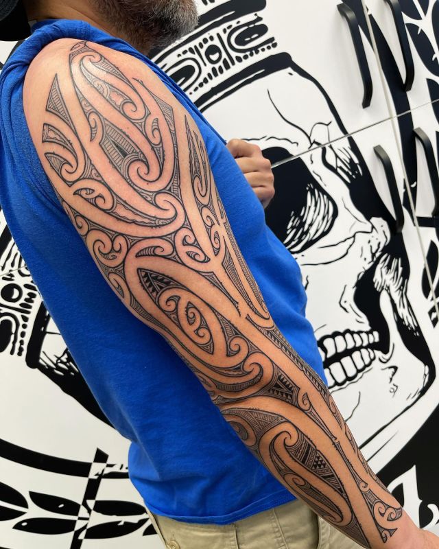 Tattoo Removal Company - Christchurch